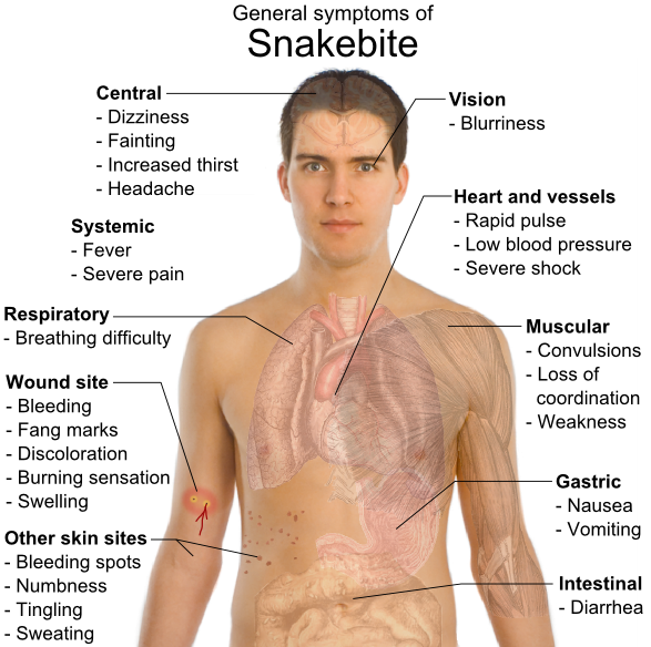 snake bote symptoms